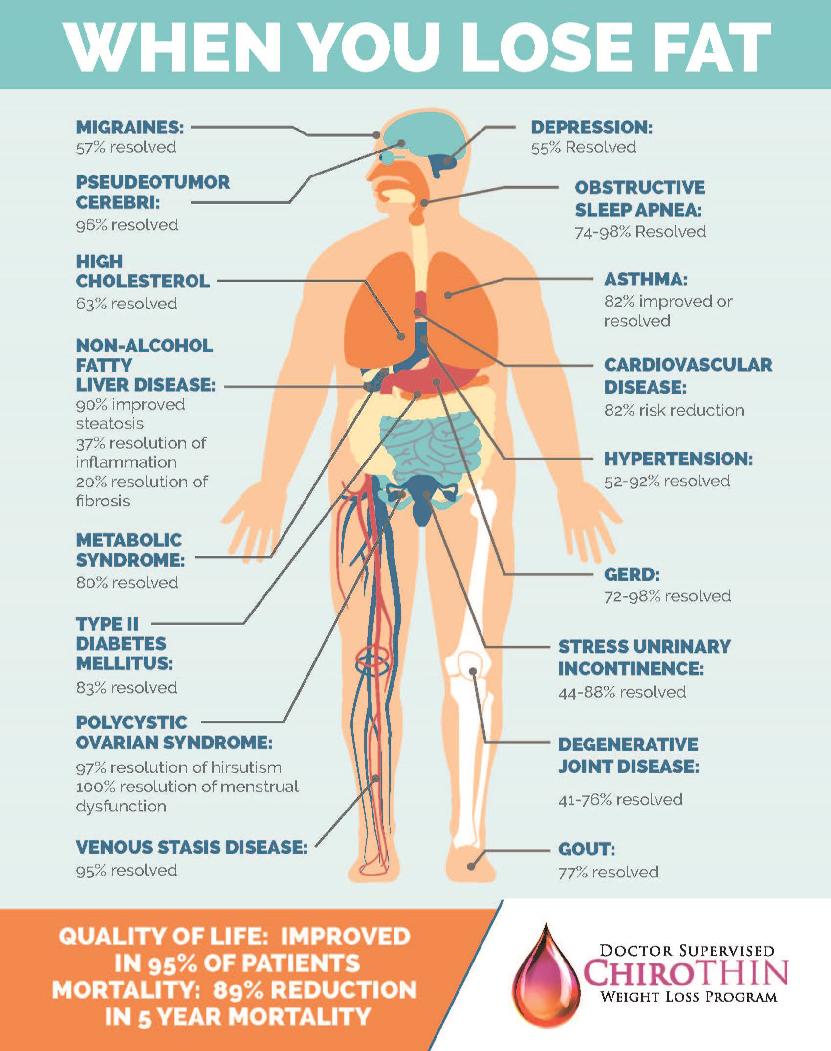 ChiroThin Weight Loss Program Align Spine Health Center, LLC